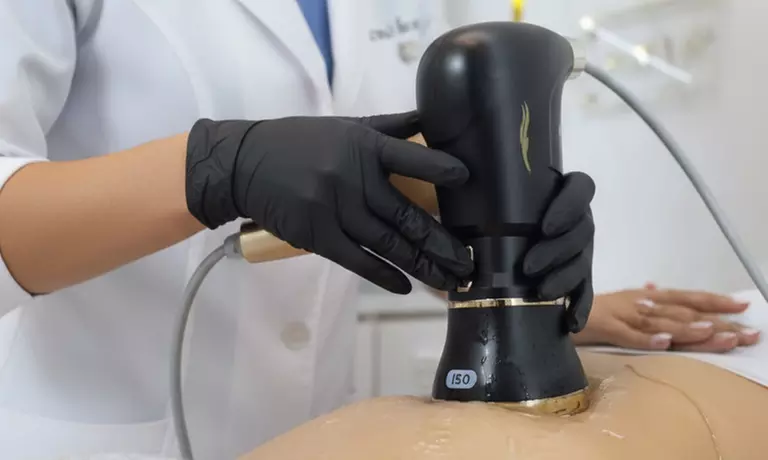 1 o 2 sesiones HIFU 22D-MAX LIPOSONIX corporal para 1 persona