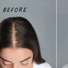 Image 5: Revive Your Glow: 1, 2 or 3 PRP Hair Loss or Facial Treatment Sessions