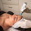 Image 3: Radio Frequency or Dermapen Skin Needling on Face & Neck or More