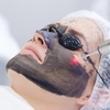 Image 2: Carbon-Peeling / Microneedling / Microneedling + BB-Glow 