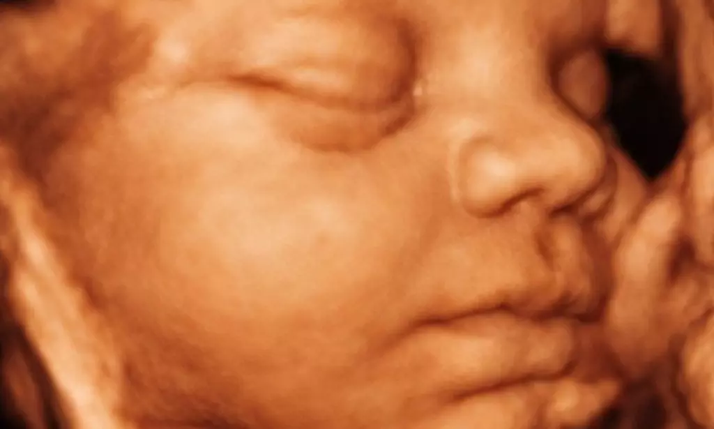 Tu bebé más cerca: ecografía 4D-5D emocional básica o plus