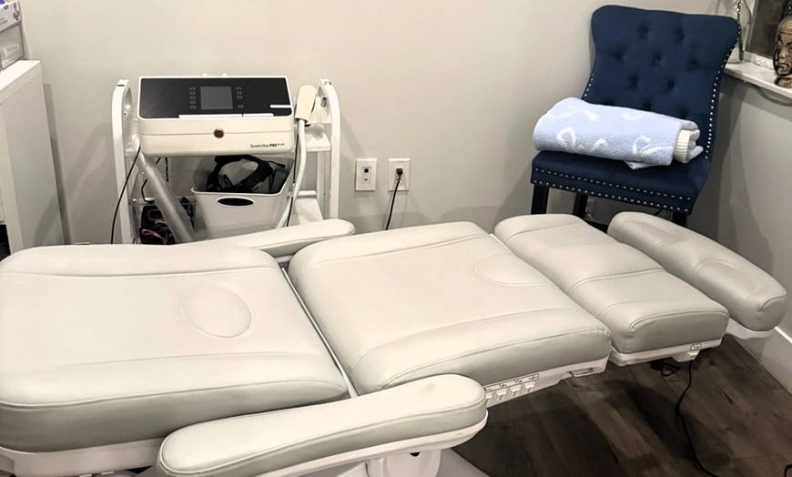 Image 6: Smooth Out Fine Lines with Botox or Juvéderm (Up to 62% Off)