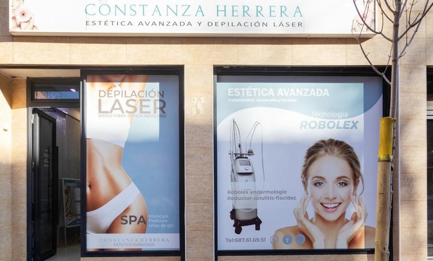 Image 3: Exosomas con dermapen en rostro completo con limpieza facial 