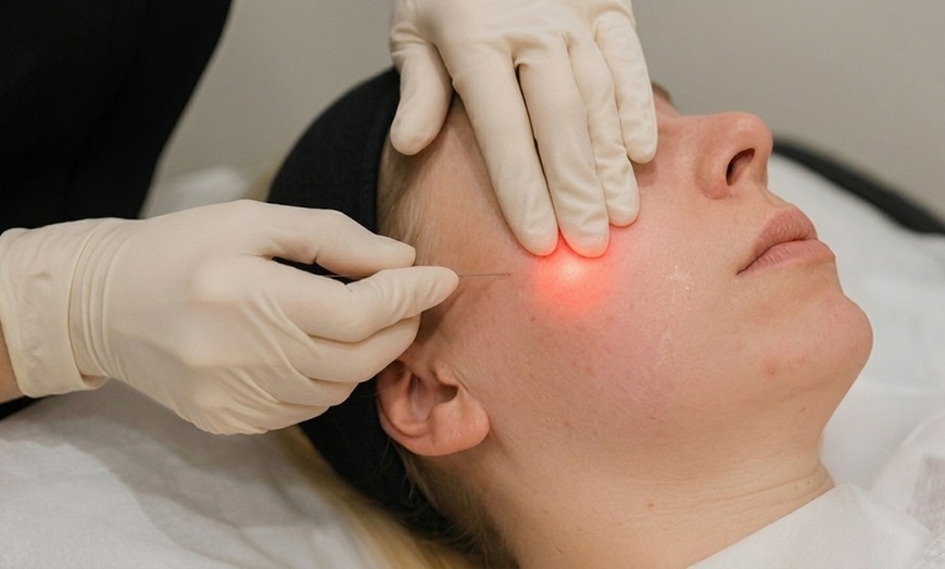 Image 3: Endolift Laser Lift and Chin Contouring and Manual Fat Removal
