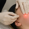 Image 3: Endolift Laser Lift and Chin Contouring and Manual Fat Removal