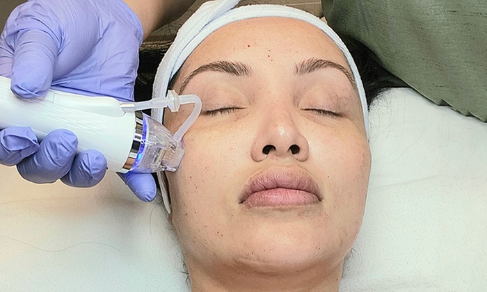 Up to 40% Off on Radio Frequency Skin Tightening at Radiant and Young Skin