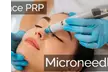 Revitalize Your Skin with One or Three PRP Facial Treatment with Micro Needling at Intuitive Spa Up to 56% Off - Second Medium
