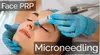 Transform Your Skin with One or Three PRP Facial Treatments With Micro-Needling (Up to 64% Off) 