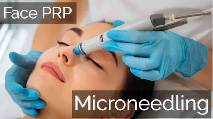 Transform Your Skin with One or Three PRP Facial Treatments With Micro-Needling (Up to 64% Off)  - Primary Image