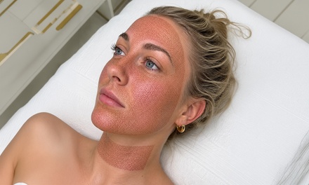 1 Plasma Fibroblast - Small Area - Upper or Lower Eye Area  - Lux Veritae Skin Spa