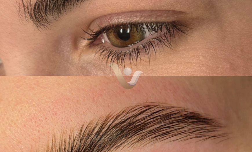 Image 4: Up to 60% Off Facials with Dermaplaning at Vibrance Med Spa