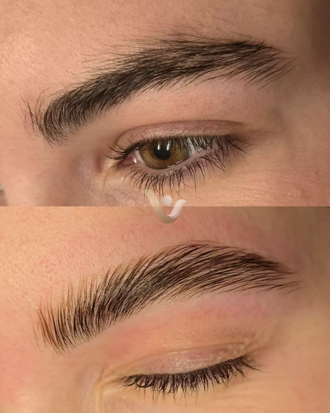 Custom Facials with Dermaplaning Treatments at Vibrance Med Spa (Up to 56% Off) - Second Medium