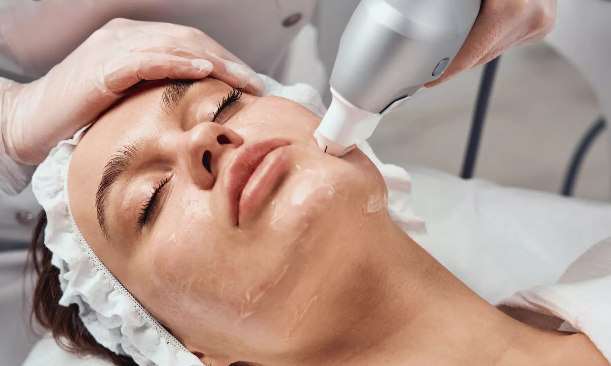 HIFU reafirmante en rostro, brazos, piernas o flancos