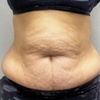Image 1: 60- or 90-Min Body Contouring for One or Multiple Areas