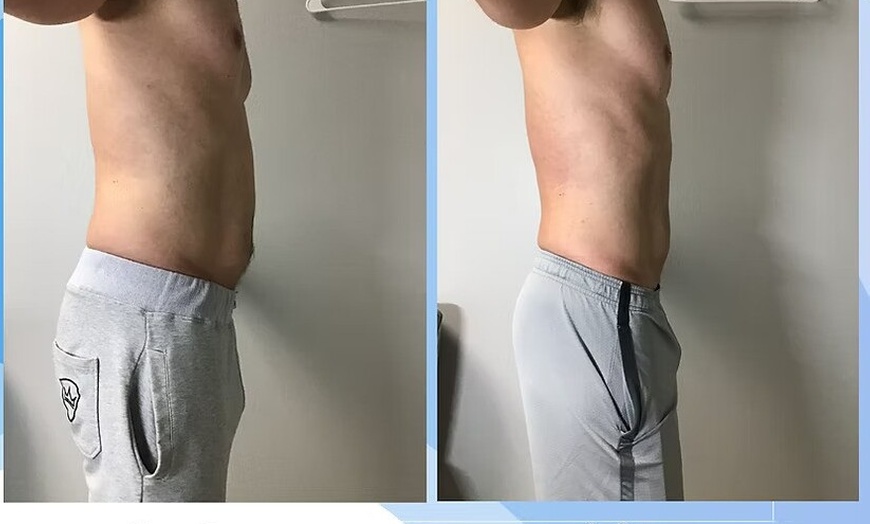 Image 2: One, Two or Three Fat Freezing Treatments Awaits for a Slimmer You
