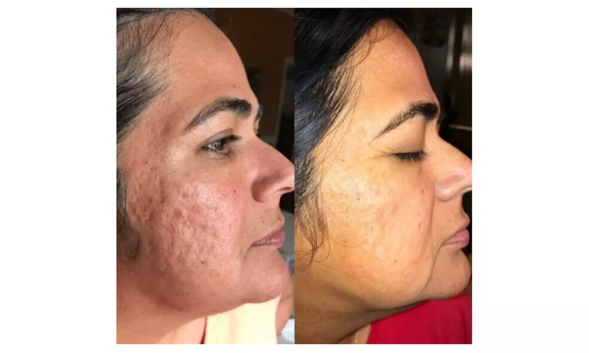 Choose Your Perfect One, Two or Three 60-Minute Choice of Facials