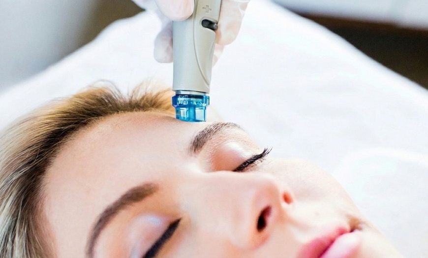 Image 4: 1-3 HydraFacial Sessions for Healthier, Glowing Skin