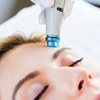 Image 4: 1-3 HydraFacial Sessions for Healthier, Glowing Skin