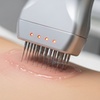 Image 3: Restore Youthful Skin with Skin Tightening, Red Light Therapy, & More 