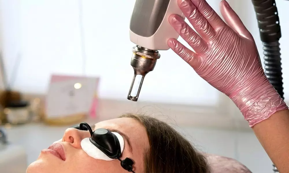 One or Two Sessions: Eyebrow Tattoo PicoLaser Removal at 24K Starlight Aesthetics (Up to 55% Off)