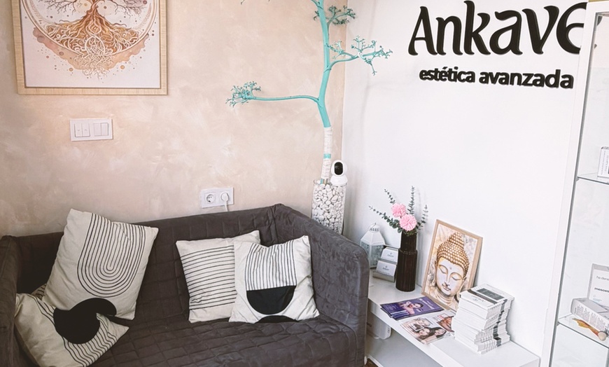 Image 4: Limpieza facial con tratamiento antiarrugas, hydralips, relleno y más