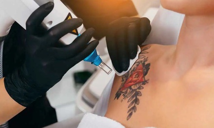 Three Laser Tattoo Removal Sessions on a Small Area (credit card and below) - Selfishly aesthetics and wellness