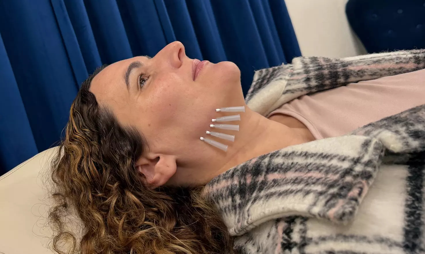 Achieve Firmer Skin With 6 or 10 PDO Collagen Threads