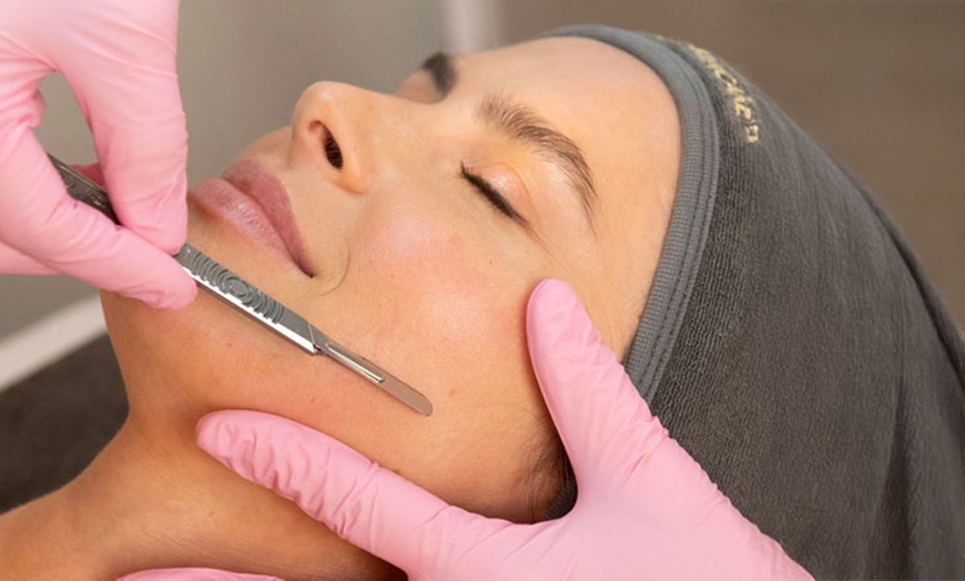 Image 2: Up to 58% Off on Microdermabrasion at Sierra Gate Facial Aesthetics
