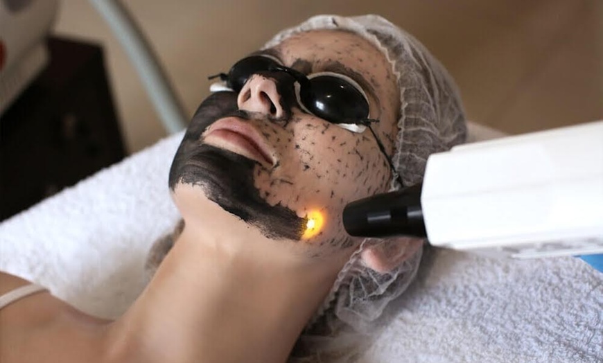 Image 1: Carbon-Peeling für Gesicht & Hals, opt. für Dekolleté, für 1 Person