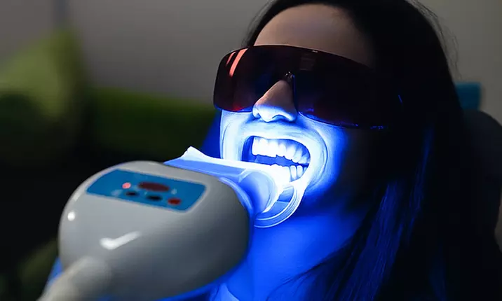 Teeth Whitening Treatment