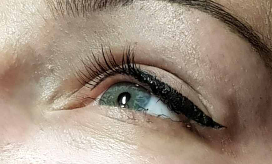 Image 2: Enhance Your Look with HIFU for Neck/Face or Both or Tattoo Eyeliner