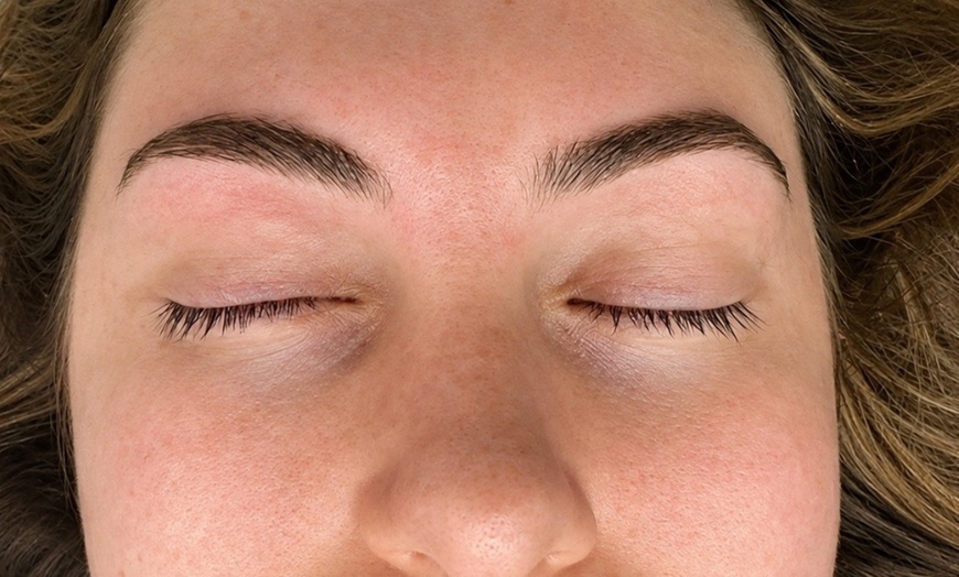 Image 3: Achieve Smoother & Brighter Skin with Signature Facial & Dermaplaning