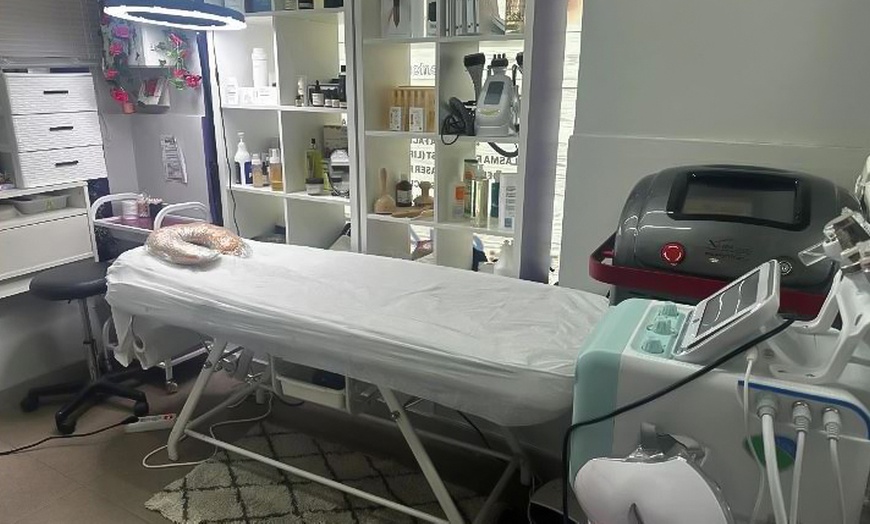 Image 2: 3 o 6 sesiones de eliminación de tatuajes con láser para 1 persona