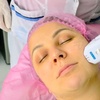 Image 1: One 12D HIFU Facelift  or Skin-Tightening Treatment