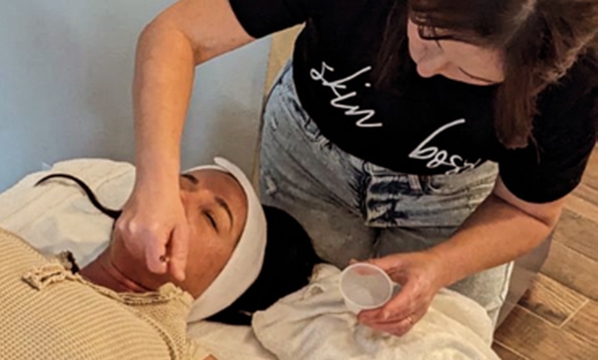 Image 4: Up to 66% Off on Chemical Peel at Immaculate complexion