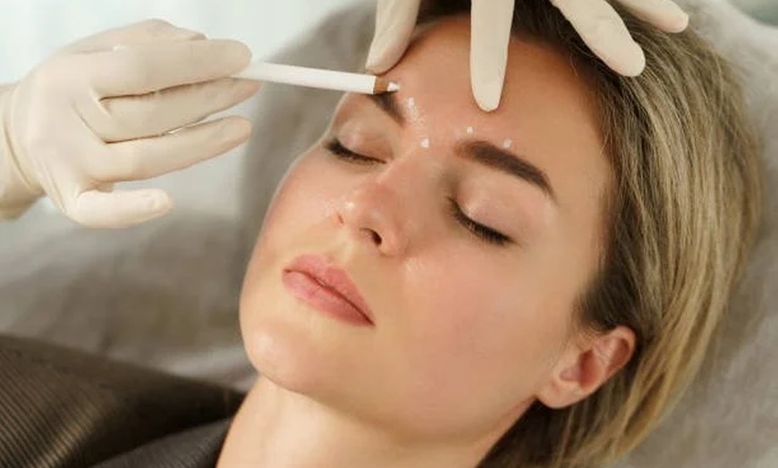 Image 3: 20, 40, or 60 Units of Botox for Fine Lines & Full-Face Refresh