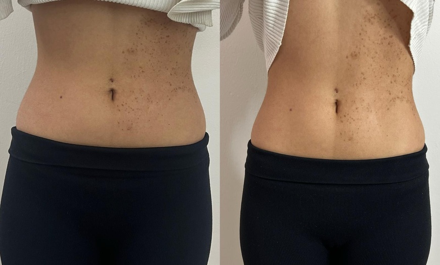 Image 5: Bis zu 42% Rabatt auf den EMS (elektrische Muskelstimulation) bei Esthétique de paris