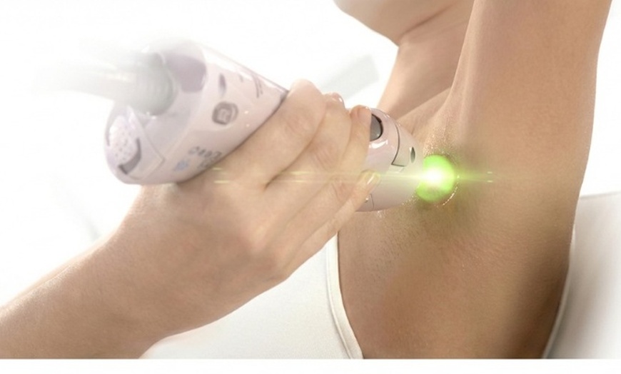 Image 4: 3 or 6 Candela Laser Hair Removal Sessions for Different Areas