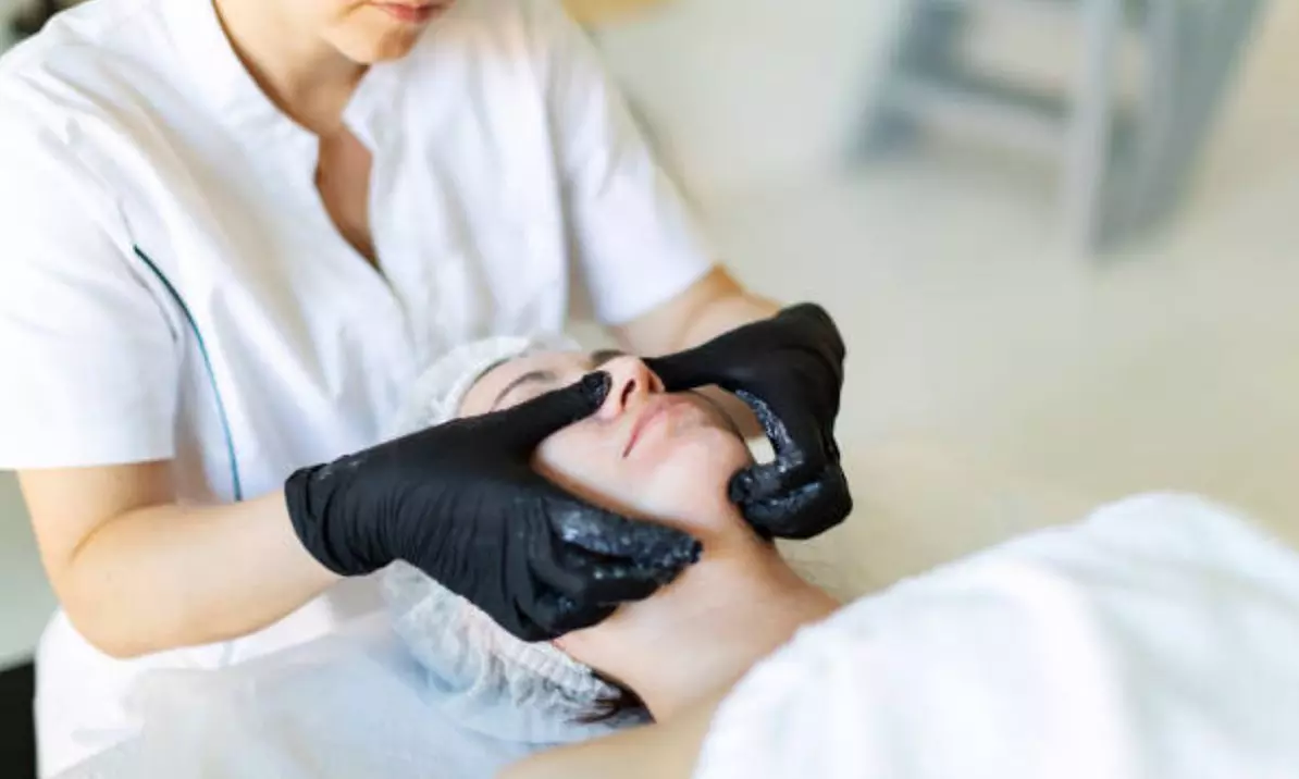 Hollywood peeling con mascarilla de carbón activo y láser