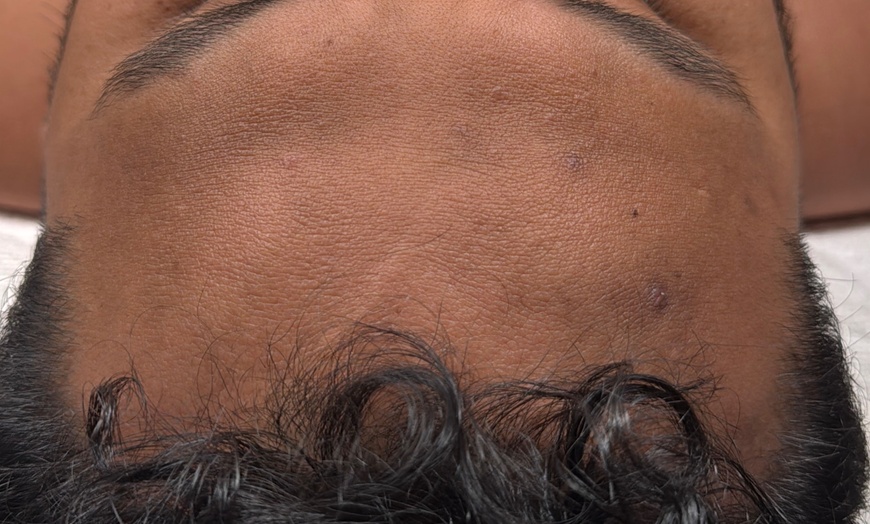 Image 2: Silk Lite Hydrodiamond Facial or Silk Deluxe Facial