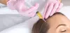 One, Two, or Three Tubes of PRP Injections for Hair Restoration at The Sunset Aesthetics (Up to 75% Off)