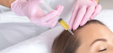 One Tube of Platelet-Rich Plasma Injections for Hair Restoration - The Sunset Aesthetics