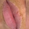 Image 4: Perfect Lips: Semi-Permanent Blush, Lip Liner & Dark Lip Correction