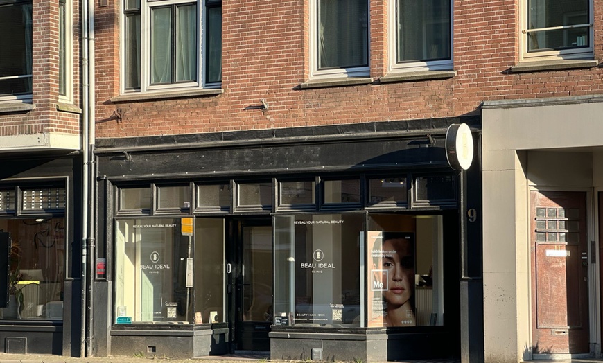 Image 7: Haren op de verkeerde plek? Laser ze naar een andere dimensie