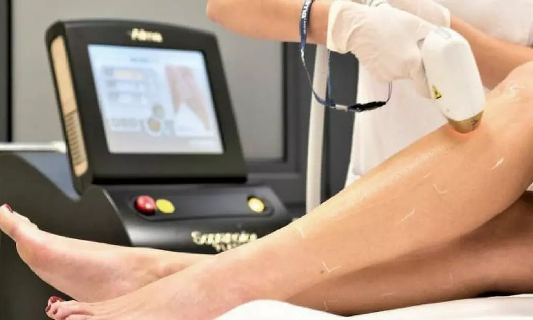 Up to 50% Off on Laser Hair Removal at Radiant Touch Skin Care Bar - Primary Image