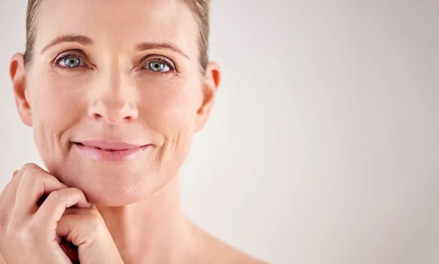 Image 1: Tratamiento de relleno dérmico con infiltración en una zona facial 