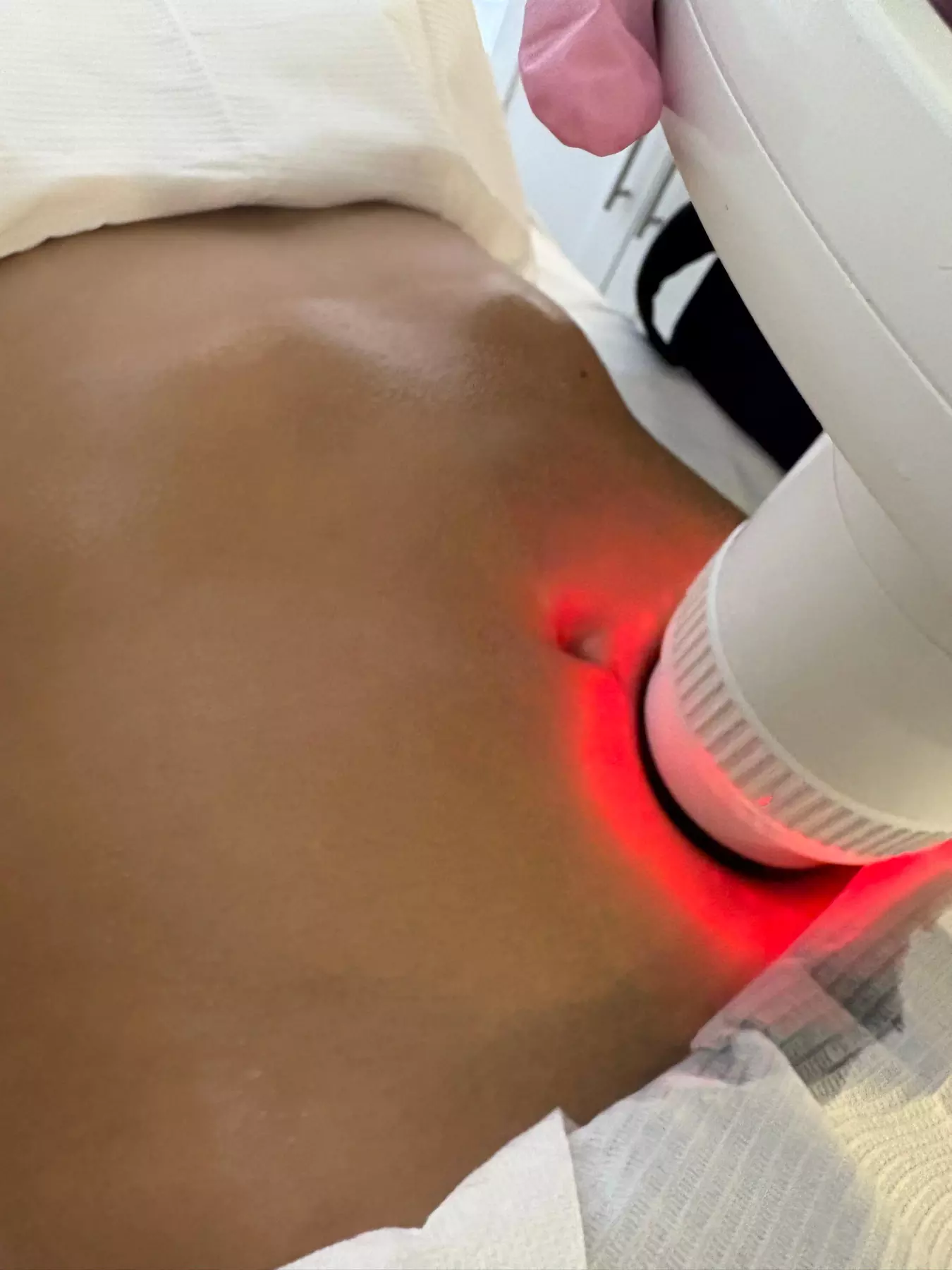 Enhance Your Shape with 1, 3, or 6 (30-Min) Body Contouring Sessions