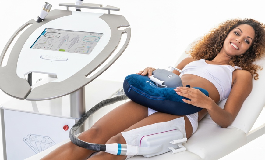 Image 4: Cryolipolysis Fat Freeze: 1–2 Areas with Up to 4 Cups of Treatment