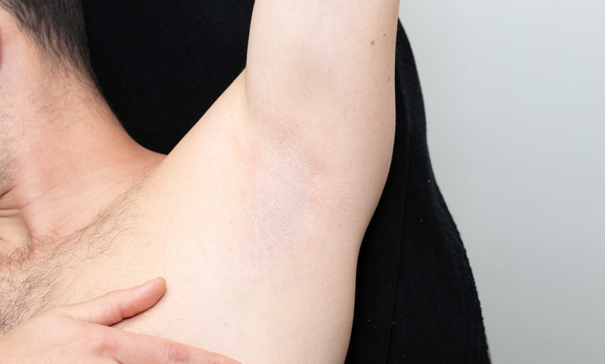 Image 8: Brazilian Wax met huidanalyse en nazorg voor een zijdezachte huid