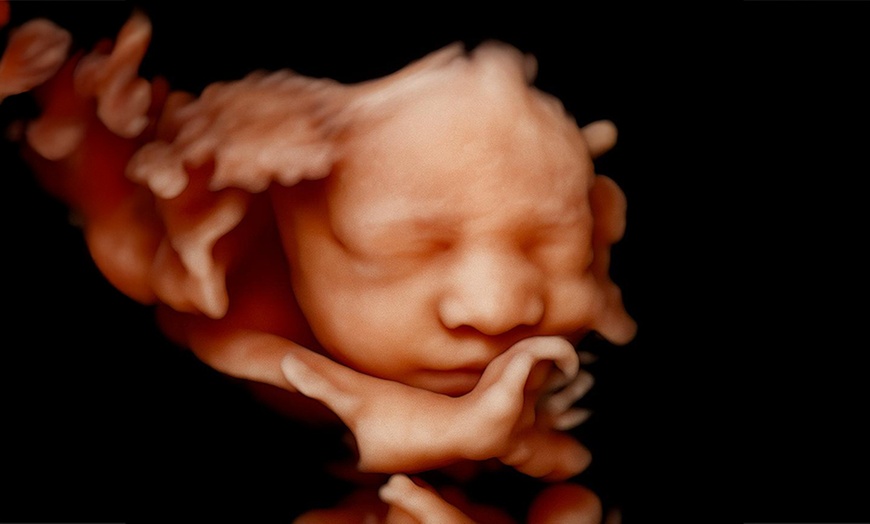 Image 4: Ecografía 4D-5D emocional básica o plus para conocer a tu bebé